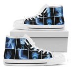X Ray Shoes