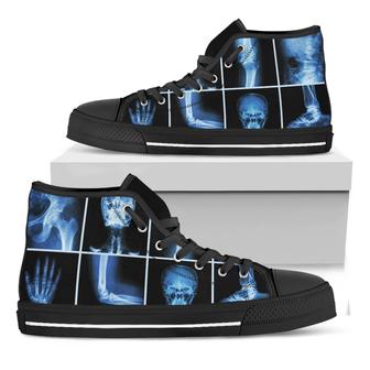 X-Ray Film Radiology Print Black High Top Shoes - Monsterry DE