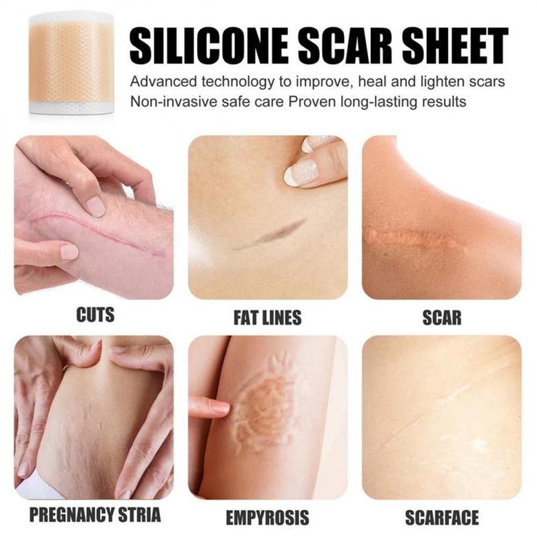 Medical Soft Silicone Gel Tape For Scar Removal