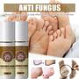 Anti-fungal Treatment Spray
